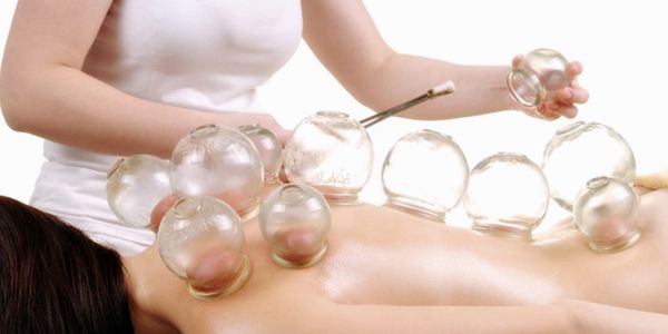 Terapia con ventosas (Cupping) cupping