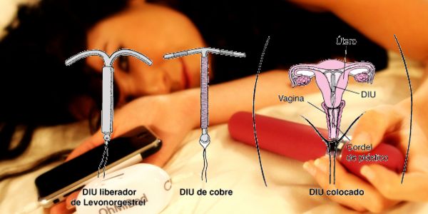 DIU o AIU con el uso de vibradores diu-o-aiu-vibradores